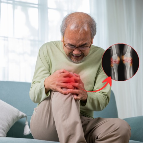 Knee pain causes illustration emphasizing osteoarthritis, ACL tear, meniscus injury, and tendinitis with focus on diagnosis and treatment